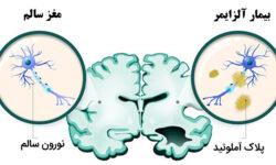 از کلاس درس تا سلامت مغز؛ چگونه یادگیری می‌تواند به تقویت ذخیره شناختی کمک کند؟