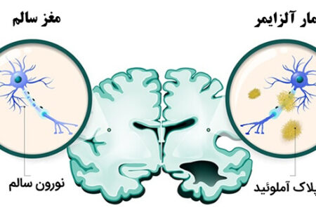 از کلاس درس تا سلامت مغز؛ چگونه یادگیری می‌تواند به تقویت ذخیره شناختی کمک کند؟