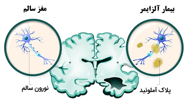 از کلاس درس تا سلامت مغز؛ چگونه یادگیری می‌تواند به تقویت ذخیره شناختی کمک کند؟